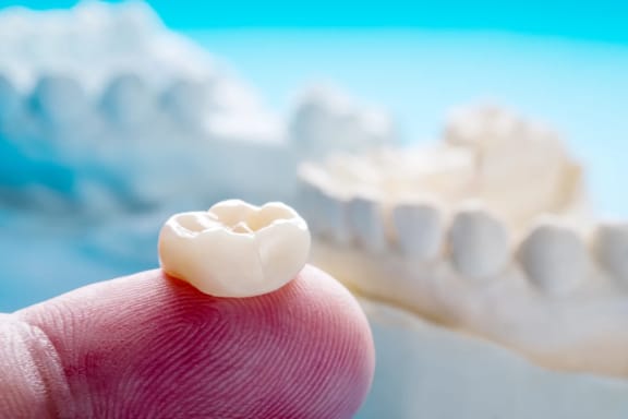 A model of a dental crown