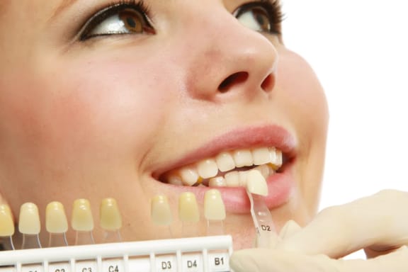 A dental shade guide