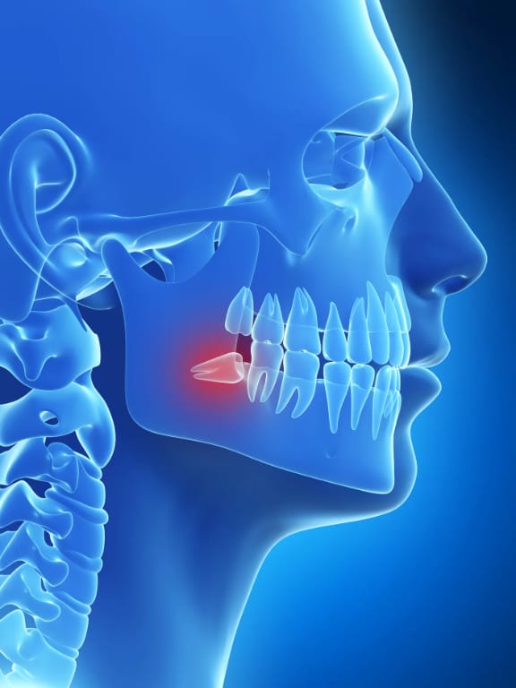 A dental provider reviewing an X-ray