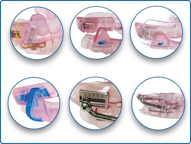 SomnoDent oral appliance
