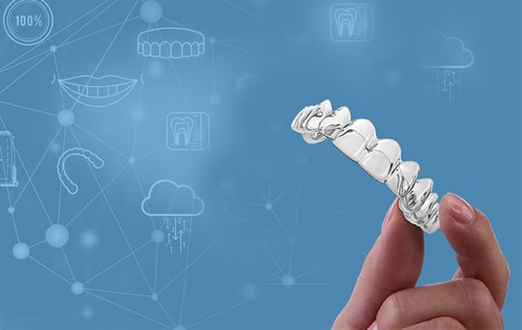 SureSmile clear aligners